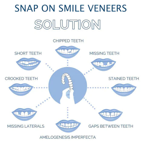 Instant Smile Reusable Snap On Veneers (Upper & Lower) - Free Delivery